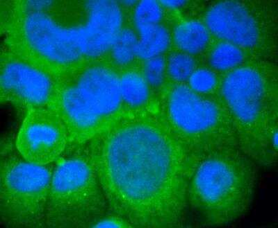 Immunocytochemistry/ Immunofluorescence: mGluR5 Antibody (ST51-00) [NBP3-11866]