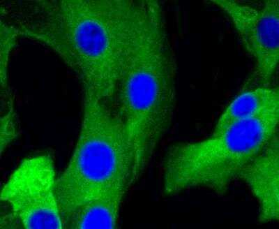 Immunocytochemistry/ Immunofluorescence: mGluR5 Antibody (ST51-00) [NBP3-11866]