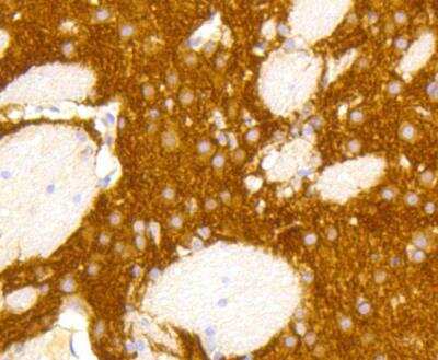 Immunohistochemistry-Paraffin: mGluR5 Antibody (ST51-00) [NBP3-11866]