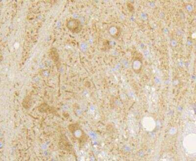 Immunohistochemistry-Paraffin: mGluR5 Antibody (ST51-00) [NBP3-11866]