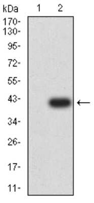Western Blot: mGluR6 Antibody (7D9C9)BSA Free [NBP2-61850]