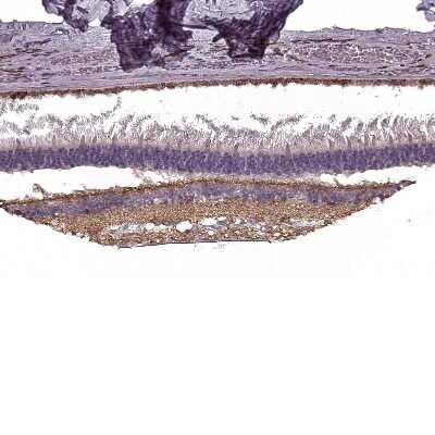 Immunohistochemistry-Paraffin: mGluR6 Antibody [NBP2-58374]