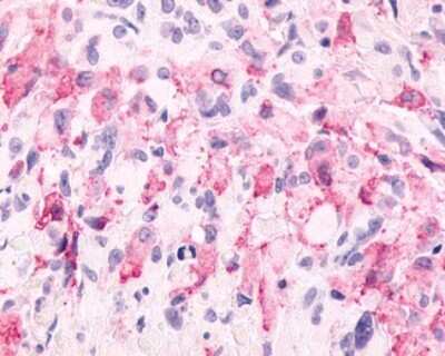 Immunohistochemistry-Paraffin: mGluR6 Antibody - BSA Free [NLS4655]