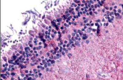 Immunohistochemistry-Paraffin: mGluR6 Antibody - BSA Free [NLS4655]