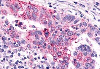 Immunohistochemistry-Paraffin: mGluR6 Antibody - BSA Free [NLS4655]