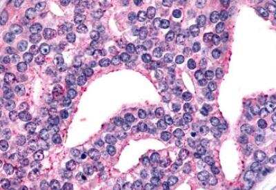 Immunohistochemistry-Paraffin: mGluR6 Antibody - BSA Free [NLS4655]