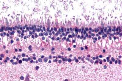 Immunohistochemistry-Paraffin: mGluR6 Antibody - BSA Free [NLS4655]