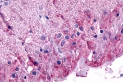 Immunohistochemistry-Paraffin: mGluR6 Antibody - BSA Free [NLS4655]