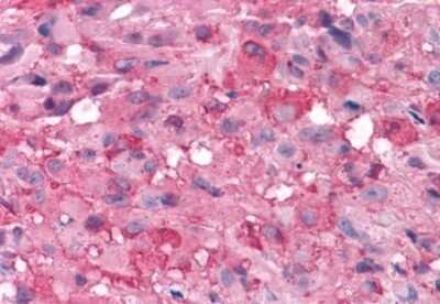 Immunohistochemistry-Paraffin: mGluR7 Antibody - BSA Free [NLS921]