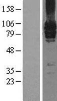 Western Blot: mGluR7 Overexpression Lysate [NBL1-11351]