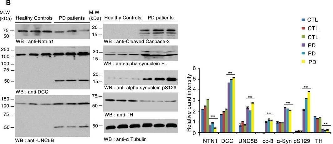 Detection of UNC5H2/UNC5B by Western Blot