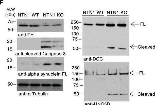 Detection of UNC5H2/UNC5B by Western Blot
