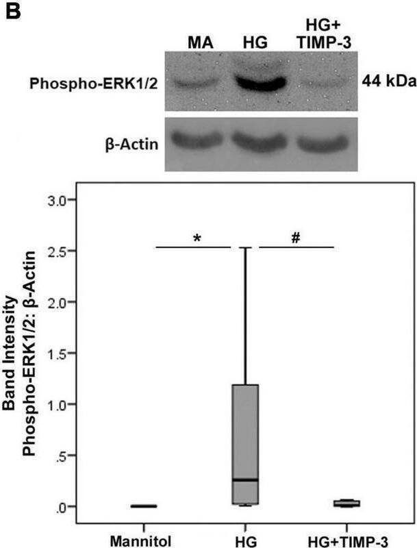 Detection of Phospho-ERK1 (T202/Y204)/ERK2 (T185/Y187) by Western Blot