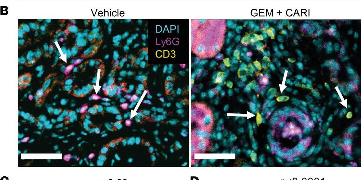 Detection of Mouse Ly-6G/Ly-6C (Gr-1) by Immunohistochemistry