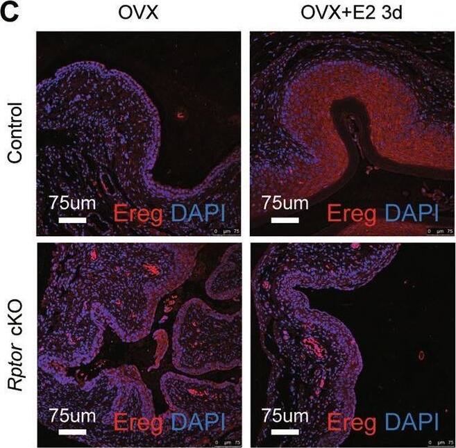 Detection of Epiregulin by Immunohistochemistry