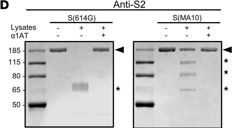 Detection of SARS-CoV-2 Spike S2 Subunit by Western Blot