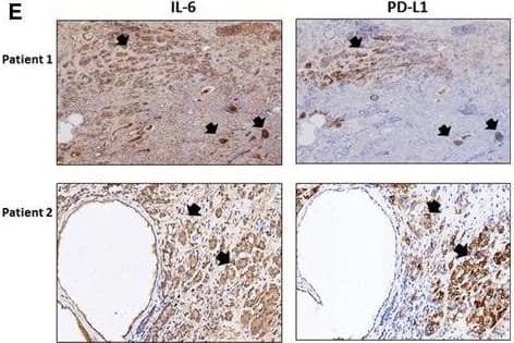 Detection of Human PD-1 by Immunohistochemistry