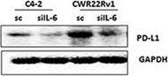 Detection of Human PD-1 by Western Blot