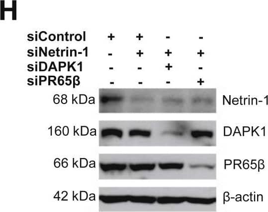 Detection of Human Netrin-1 by Western Blot