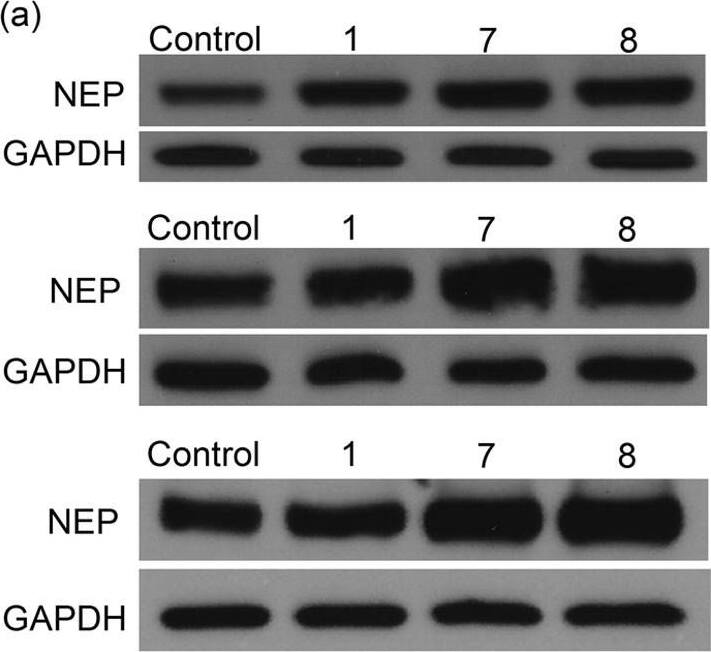 Detection of Human Neprilysin/CD10 by Western Blot