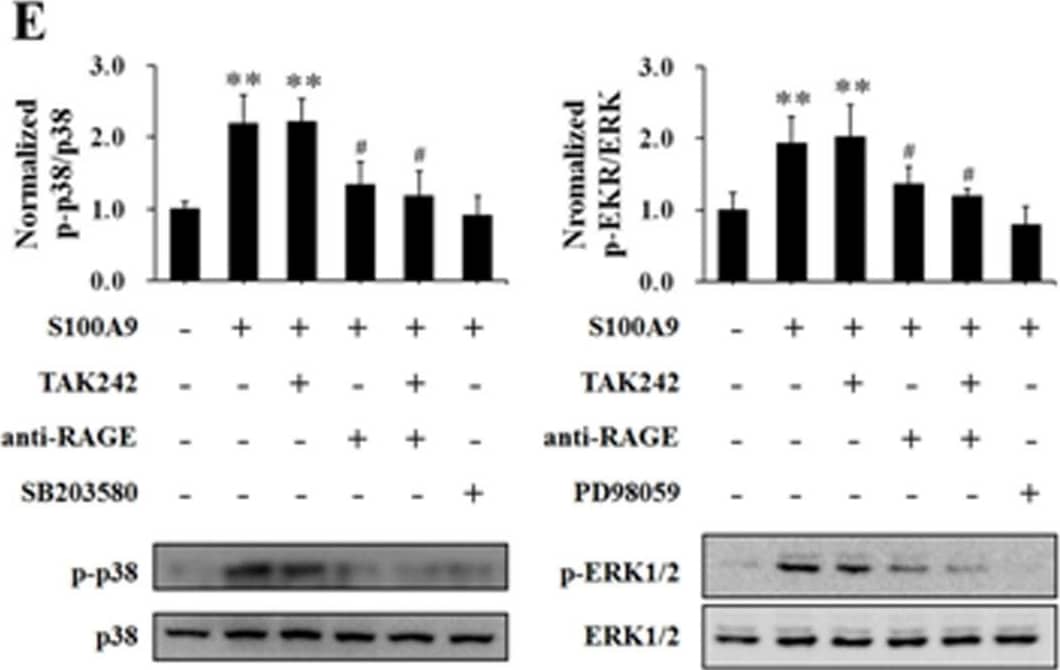 Detection of AGER by Western Blot