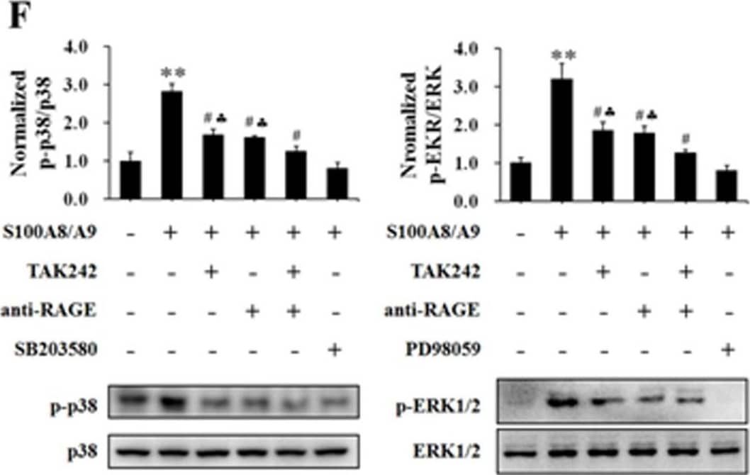 Detection of AGER by Western Blot