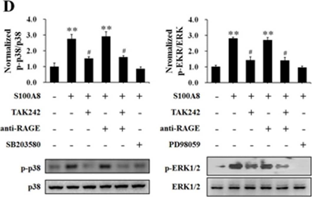 Detection of AGER by Western Blot