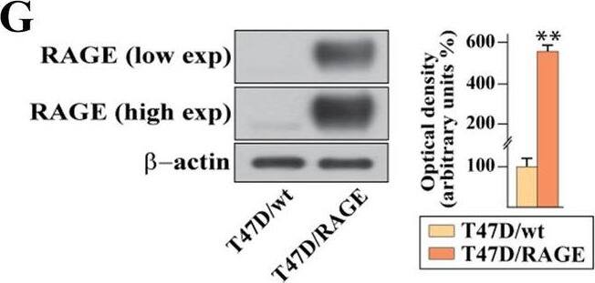 Detection of RAGE by Western Blot