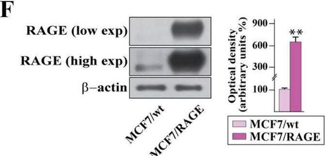 Detection of RAGE by Western Blot