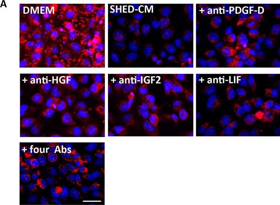 Detection of PDGF-D by Immunocytochemistry/ Immunofluorescence