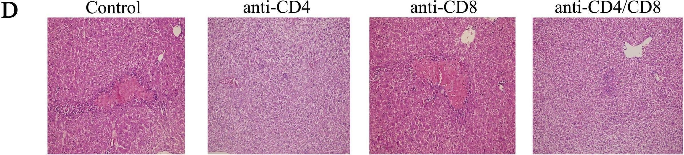 Detection of CD8 alpha by Immunohistochemistry