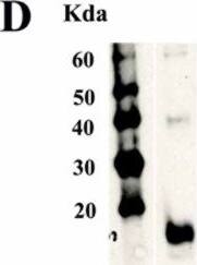 Detection of Human IL-18 R beta/IL-1 R7/ACPL by Western Blot