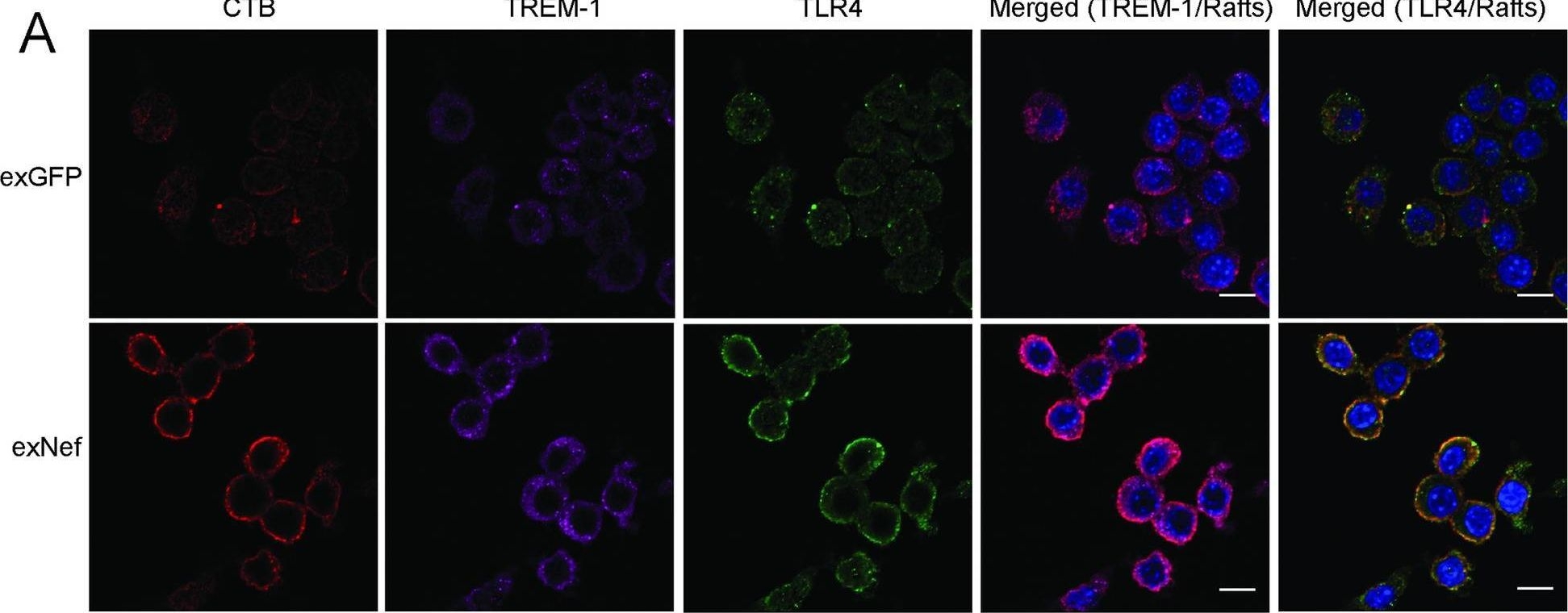 Detection of TREM-1 by Immunocytochemistry/ Immunofluorescence
