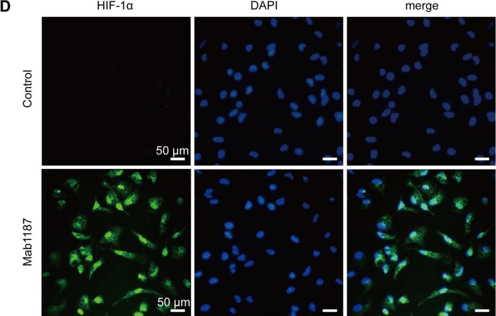 Detection of TREM-1 by Immunocytochemistry/ Immunofluorescence