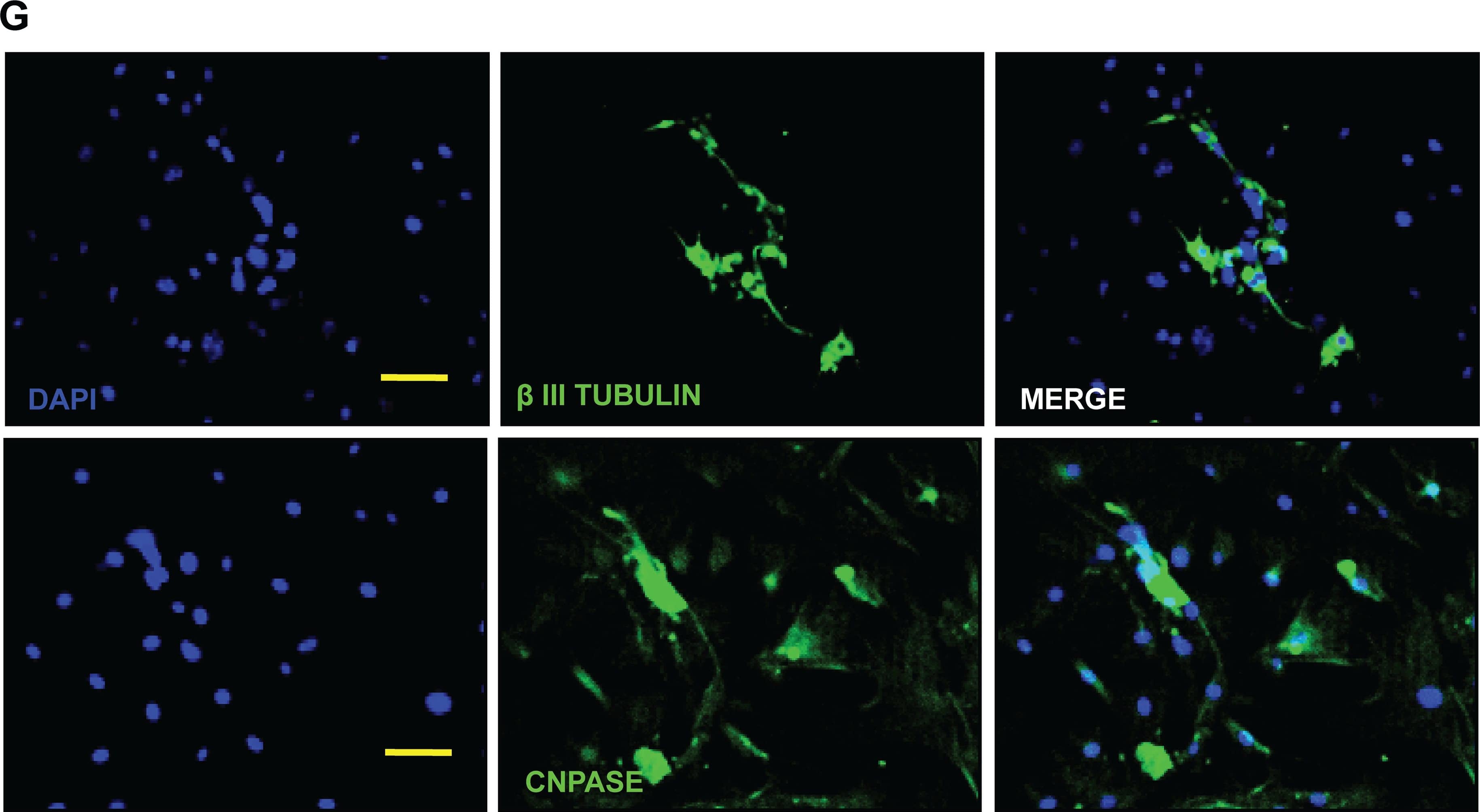 Detection of Mouse Neuron-specific beta-III Tubulin Antibody by Immunocytochemistry/ Immunofluorescence
