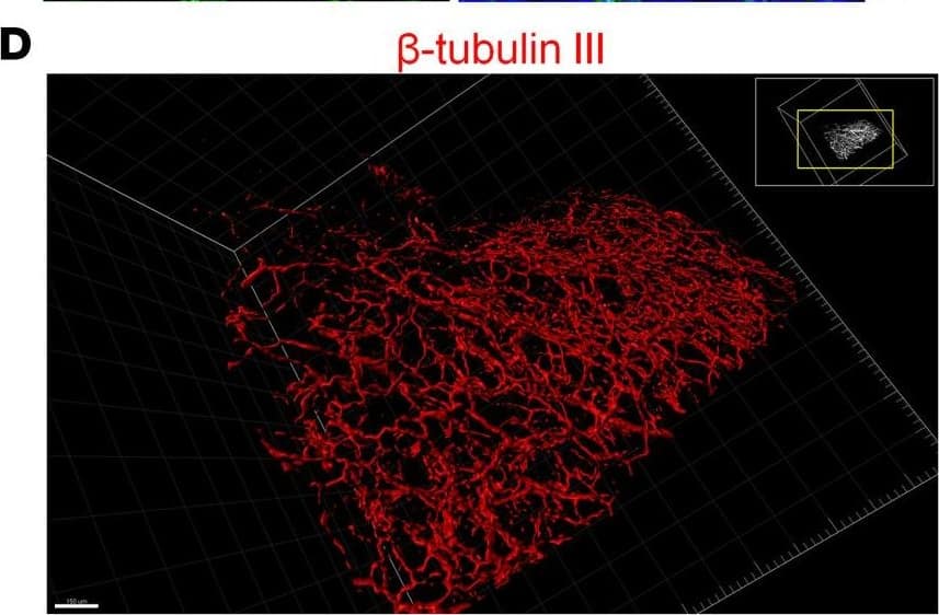 Detection of Mouse Neuron-specific beta-III Tubulin Antibody by Immunohistochemistry