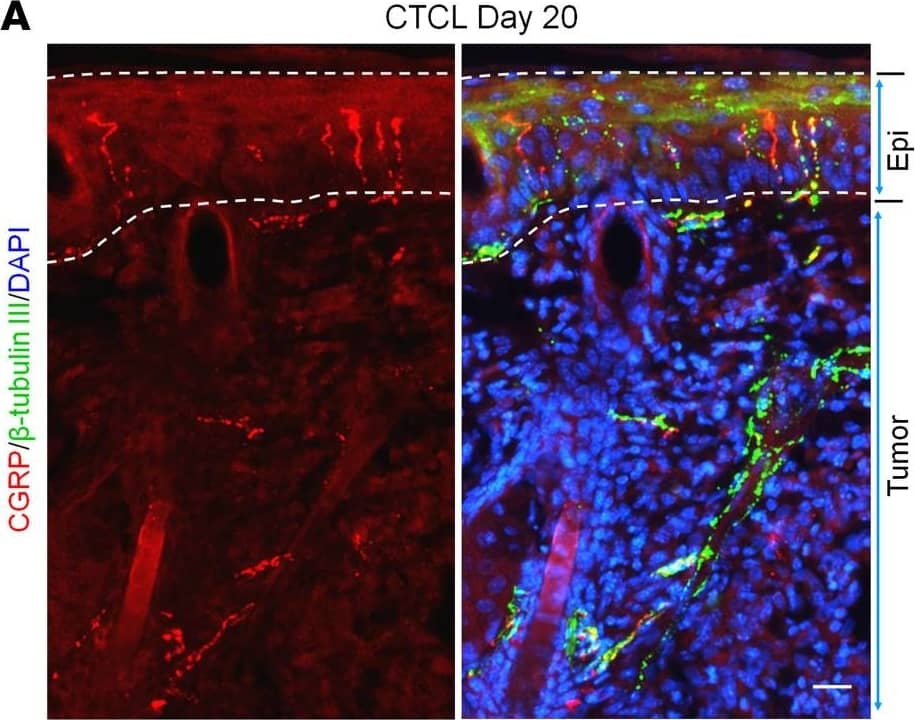 Detection of Mouse Neuron-specific beta-III Tubulin Antibody by Immunohistochemistry