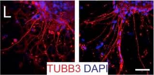 Detection of Human Neuron-specific beta-III Tubulin Antibody by Immunocytochemistry/ Immunofluorescence