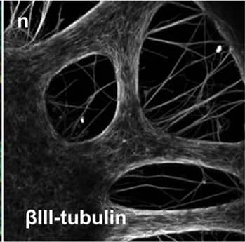 Detection of Human beta-III Tubulin by Immunocytochemistry/Immunofluorescence