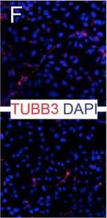 Detection of Human beta-III Tubulin by Immunocytochemistry/Immunofluorescence