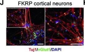 Detection of Human beta-III Tubulin by Immunocytochemistry/Immunofluorescence