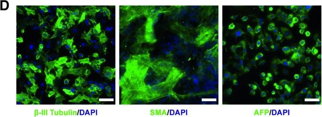 Detection of Human beta-III Tubulin by Immunocytochemistry/Immunofluorescence