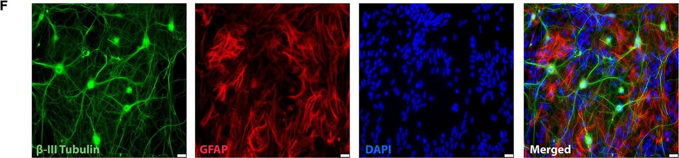 Detection of Mouse beta-III Tubulin by Immunocytochemistry/Immunofluorescence