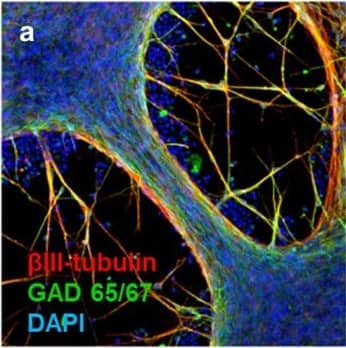Detection of Human beta-III Tubulin by Immunocytochemistry/Immunofluorescence