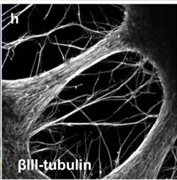 Detection of Human beta-III Tubulin by Immunocytochemistry/Immunofluorescence