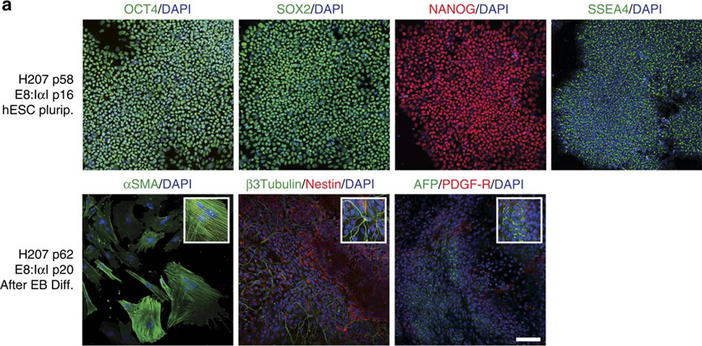 Detection of Human beta-III Tubulin by Immunocytochemistry/Immunofluorescence