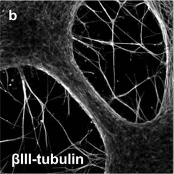 Detection of Human beta-III Tubulin by Immunocytochemistry/Immunofluorescence