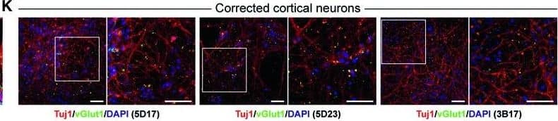 Detection of Human beta-III Tubulin by Immunocytochemistry/Immunofluorescence