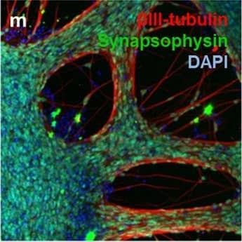 Detection of Human beta-III Tubulin by Immunocytochemistry/Immunofluorescence