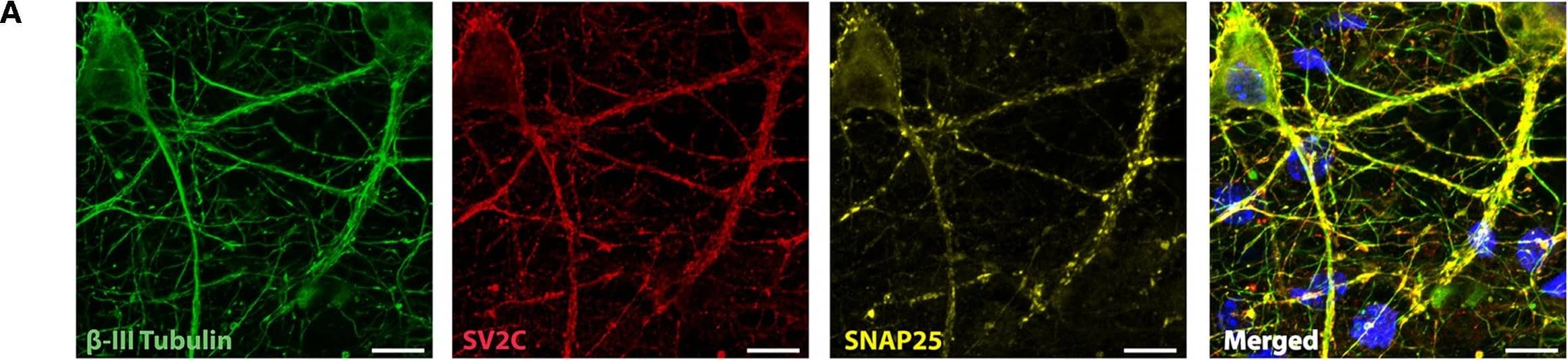 Detection of Mouse beta-III Tubulin by Immunocytochemistry/Immunofluorescence